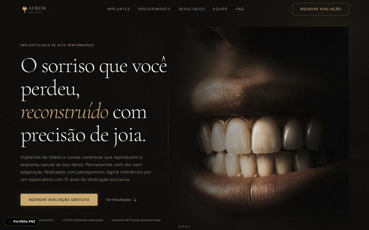 Site Aurum Implantes: landing page de odontologia